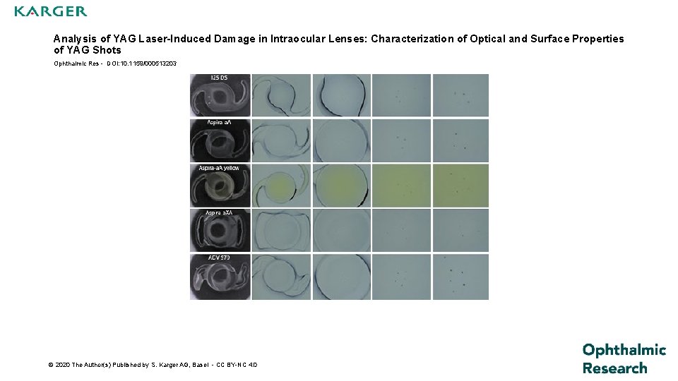 Analysis of YAG Laser-Induced Damage in Intraocular Lenses: Characterization of Optical and Surface Properties