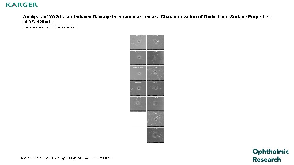 Analysis of YAG Laser-Induced Damage in Intraocular Lenses: Characterization of Optical and Surface Properties