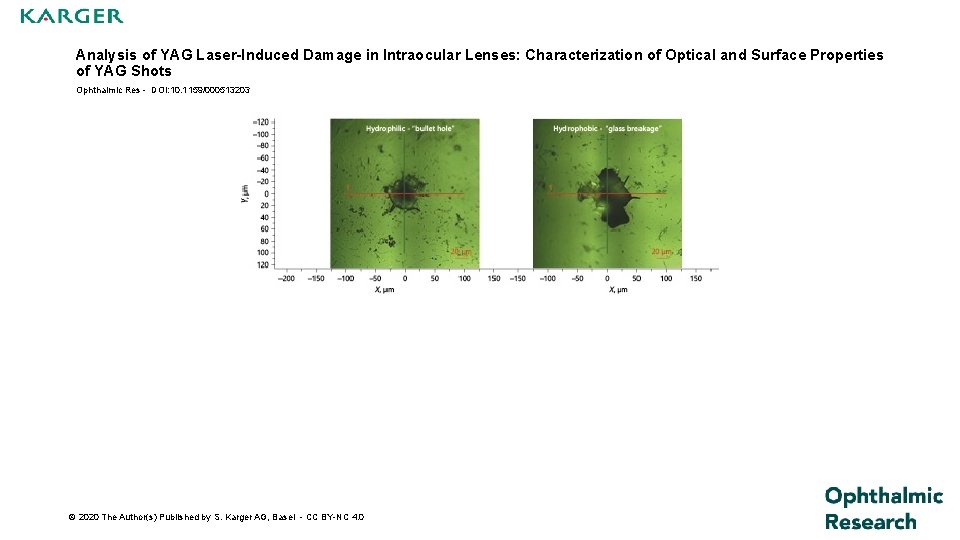 Analysis of YAG Laser-Induced Damage in Intraocular Lenses: Characterization of Optical and Surface Properties