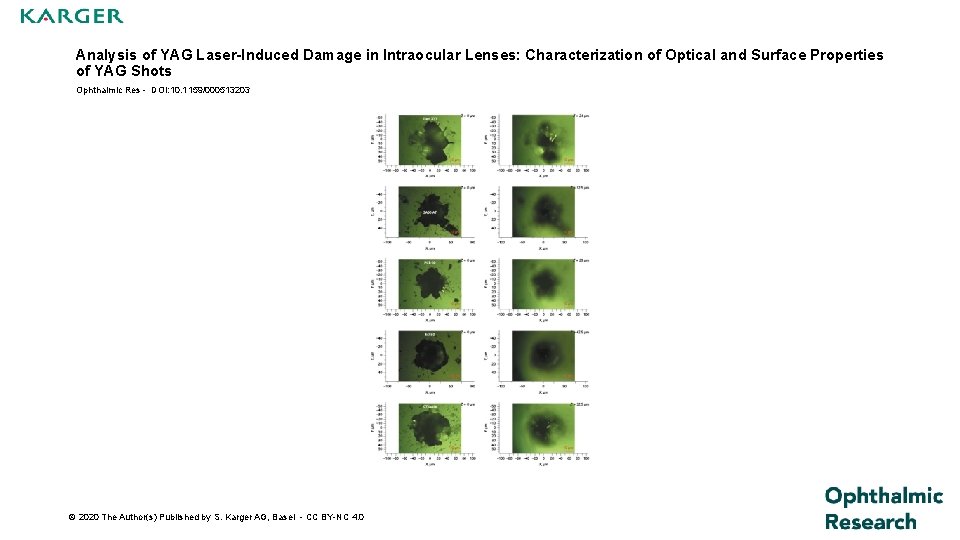 Analysis of YAG Laser-Induced Damage in Intraocular Lenses: Characterization of Optical and Surface Properties