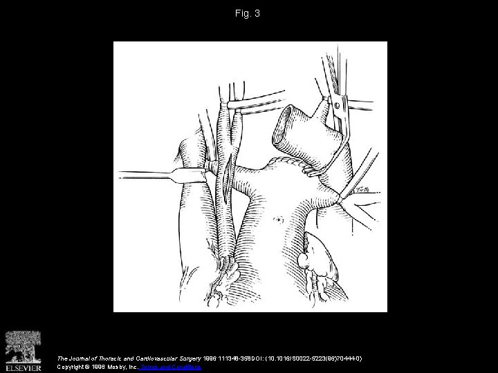 Fig. 3 The Journal of Thoracic and Cardiovascular Surgery 1996 111348 -358 DOI: (10.