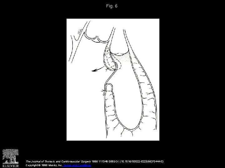 Fig. 6 The Journal of Thoracic and Cardiovascular Surgery 1996 111348 -358 DOI: (10.