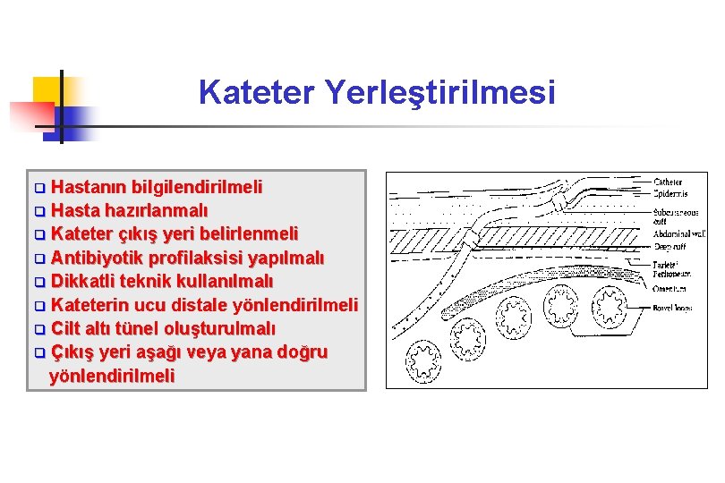 Kateter Yerleştirilmesi Hastanın bilgilendirilmeli q Hasta hazırlanmalı q Kateter çıkış yeri belirlenmeli q Antibiyotik