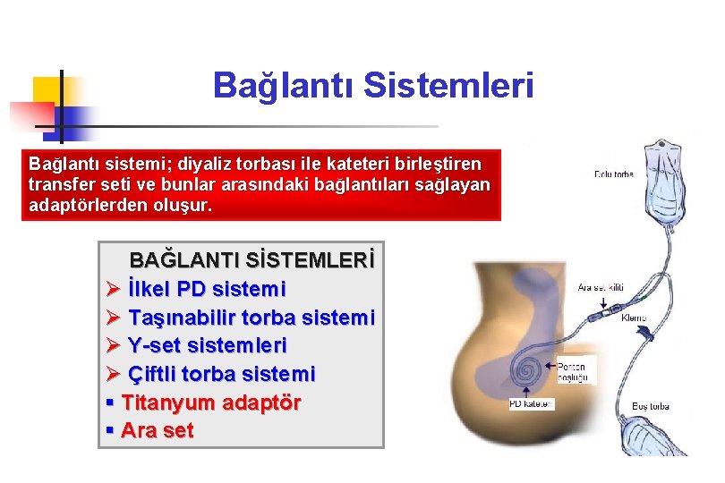 Bağlantı Sistemleri Bağlantı sistemi; diyaliz torbası ile kateteri birleştiren transfer seti ve bunlar arasındaki