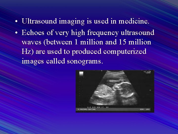  • Ultrasound imaging is used in medicine. • Echoes of very high frequency