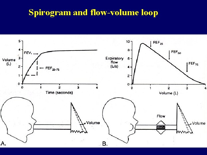 Spirogram and flow-volume loop 