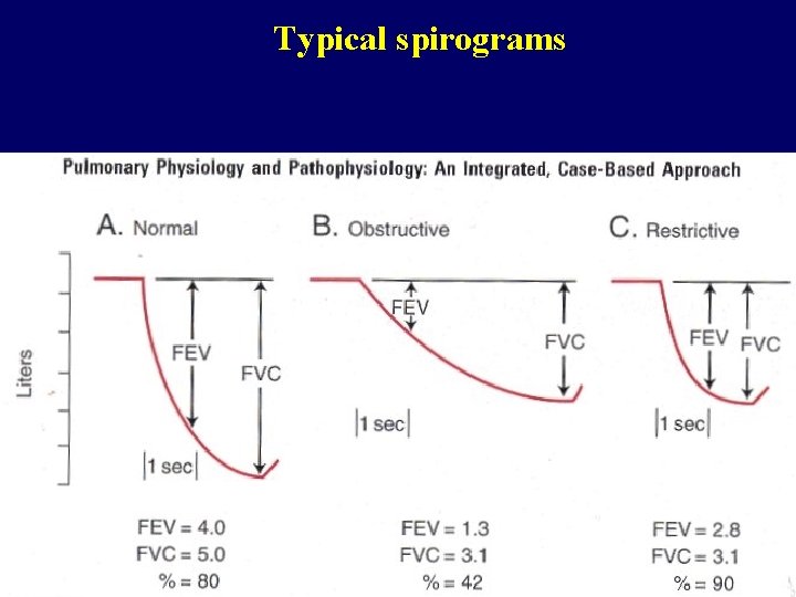Typical spirograms 