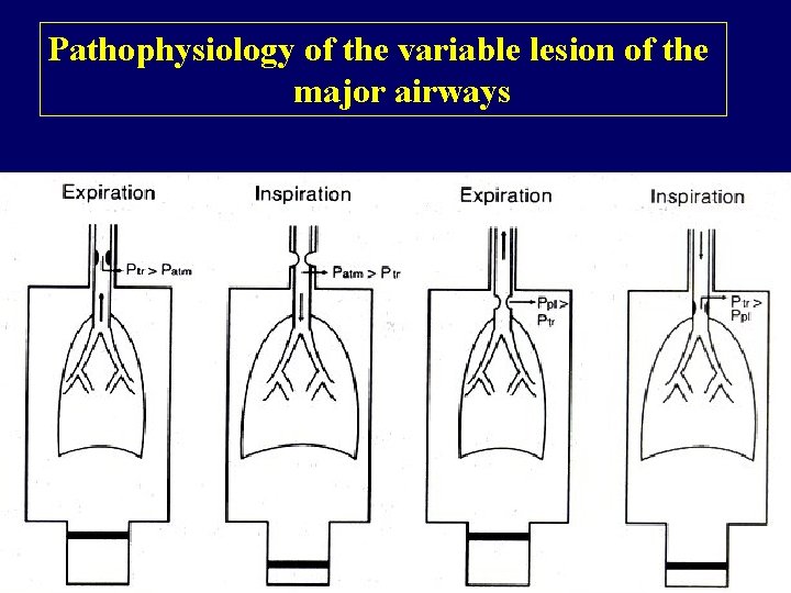 Pathophysiology of the variable lesion of the major airways 