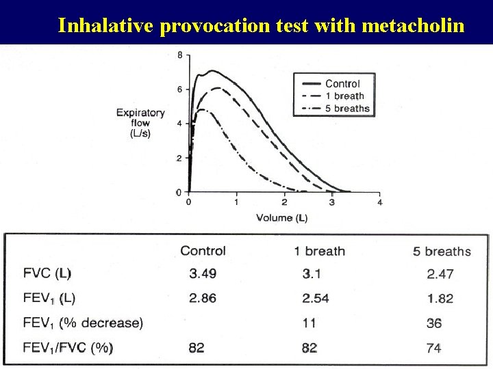 Inhalative provocation test with metacholin 