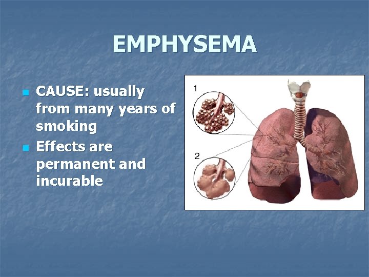 EMPHYSEMA n n CAUSE: usually from many years of smoking Effects are permanent and