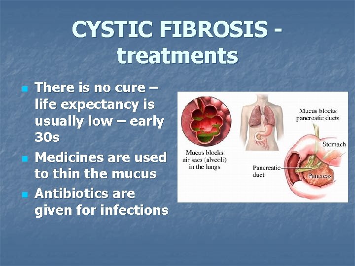 CYSTIC FIBROSIS treatments n n n There is no cure – life expectancy is
