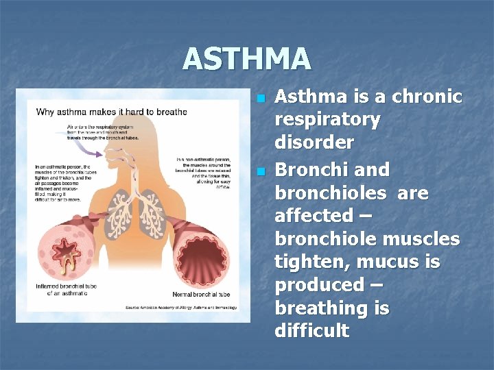 ASTHMA n n Asthma is a chronic respiratory disorder Bronchi and bronchioles are affected