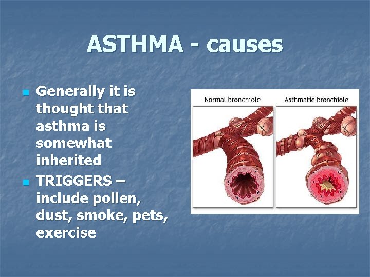 ASTHMA - causes n n Generally it is thought that asthma is somewhat inherited