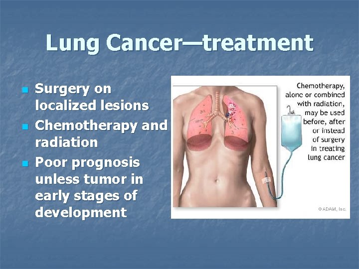 Lung Cancer—treatment n n n Surgery on localized lesions Chemotherapy and radiation Poor prognosis
