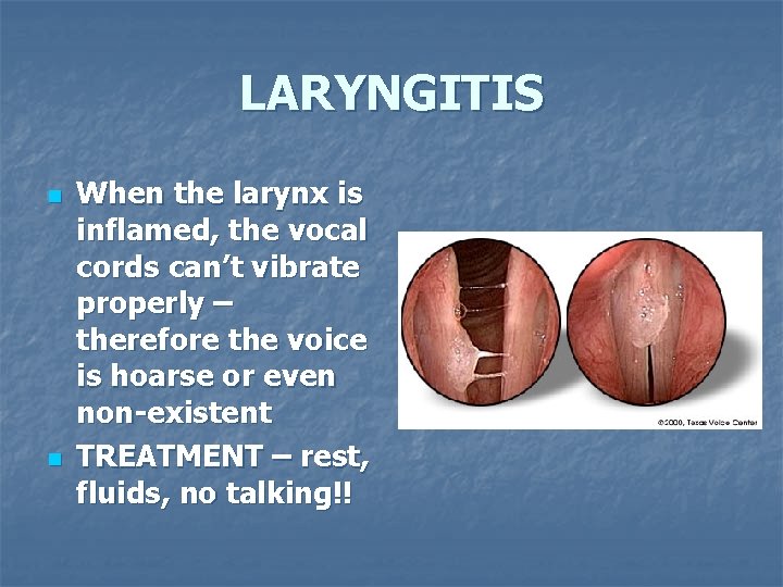 LARYNGITIS n n When the larynx is inflamed, the vocal cords can’t vibrate properly
