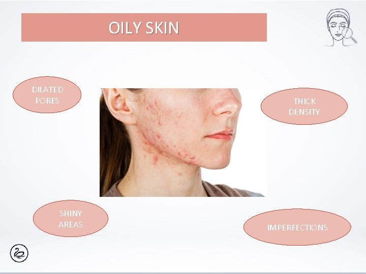 OILY SKIN DILATED PORES SHINY AREAS THICK DENSITY IMPERFECTIONS 