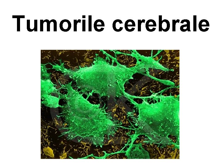Tumorile cerebrale 