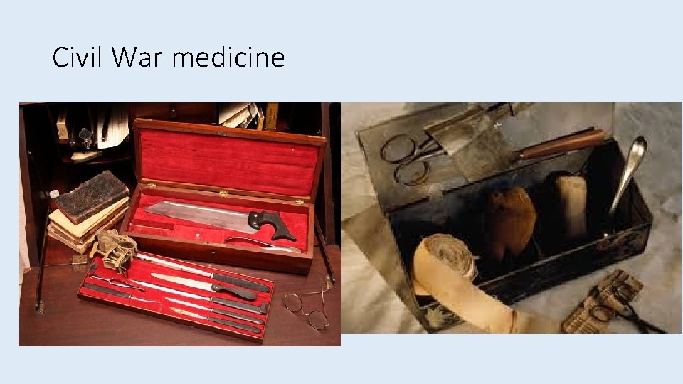 Civil War medicine 