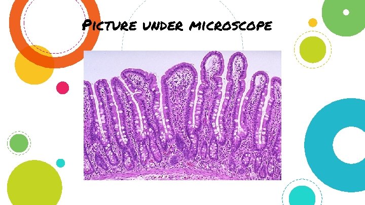 Picture under microscope 