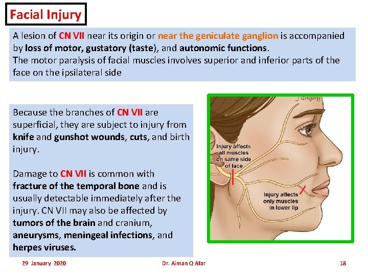 Facial Injury A lesion of CN VII near its origin or near the geniculate Facial Injury A lesion of CN VII near its origin or near the geniculate