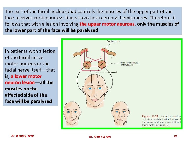 The part of the facial nucleus that controls the muscles of the upper part The part of the facial nucleus that controls the muscles of the upper part