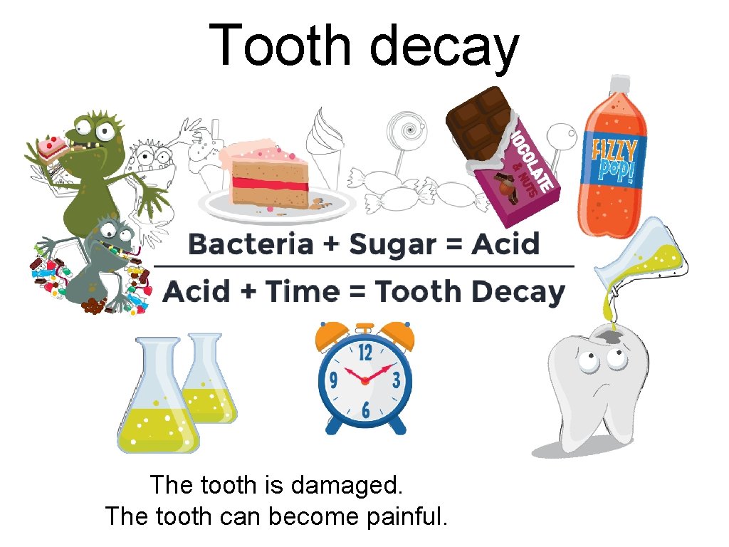 Tooth decay The tooth is damaged. The tooth can become painful. Tooth decay The tooth is damaged. The tooth can become painful.