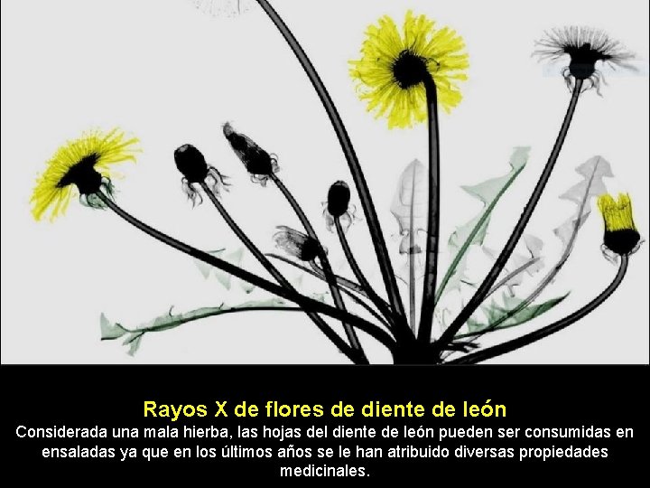 Rayos X de flores de diente de león Considerada una mala hierba, las hojas