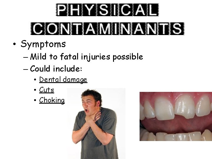  • Symptoms – Mild to fatal injuries possible – Could include: • Dental