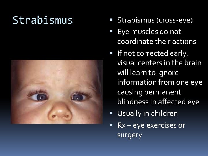 Strabismus (cross-eye) Eye muscles do not coordinate their actions If not corrected early, visual