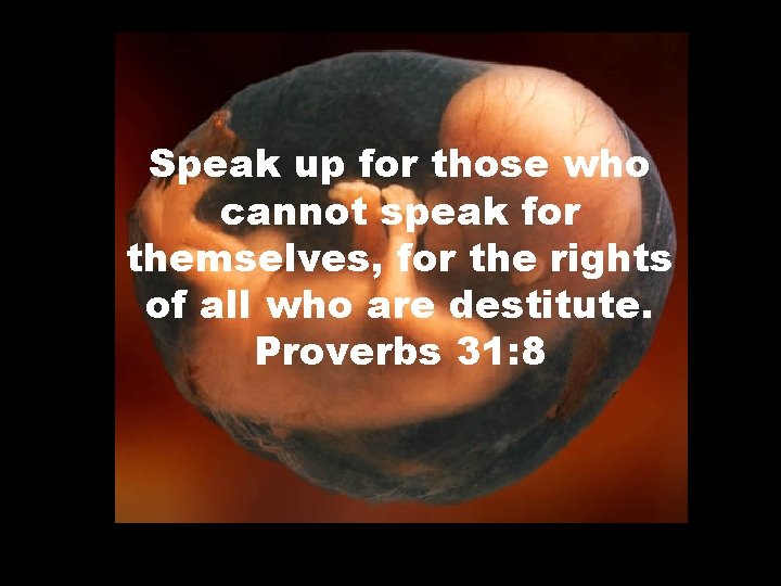 Speak up for those who cannot speak for themselves, for the rights of all