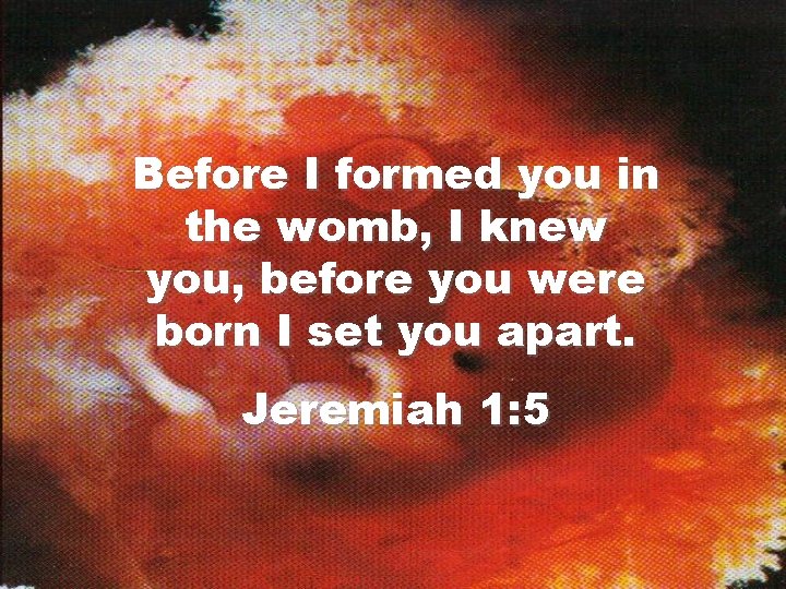 Before I formed you in the womb, I knew you, before you were born