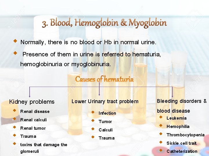  Normally, there is no blood or Hb in normal urine. Presence of them