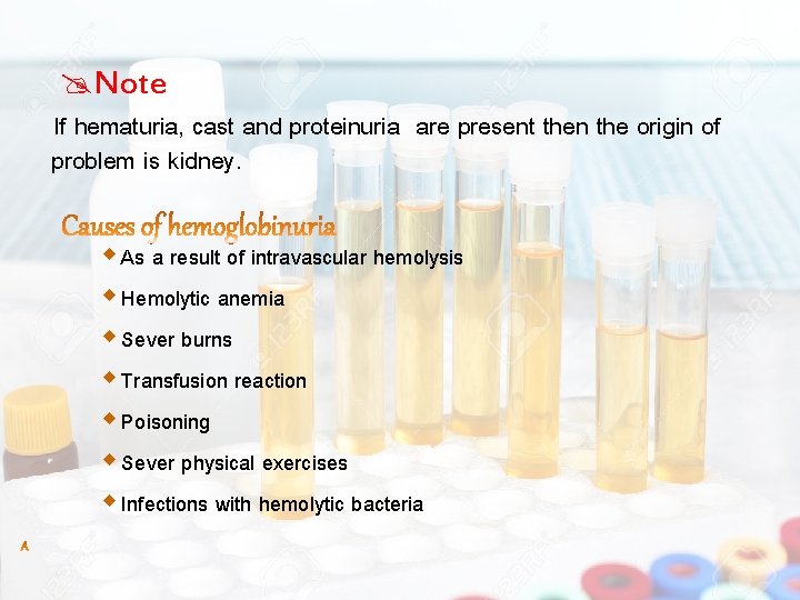  Note If hematuria, cast and proteinuria are present then the origin of problem
