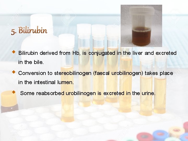  Bilirubin derived from Hb, is conjugated in the liver and excreted in the