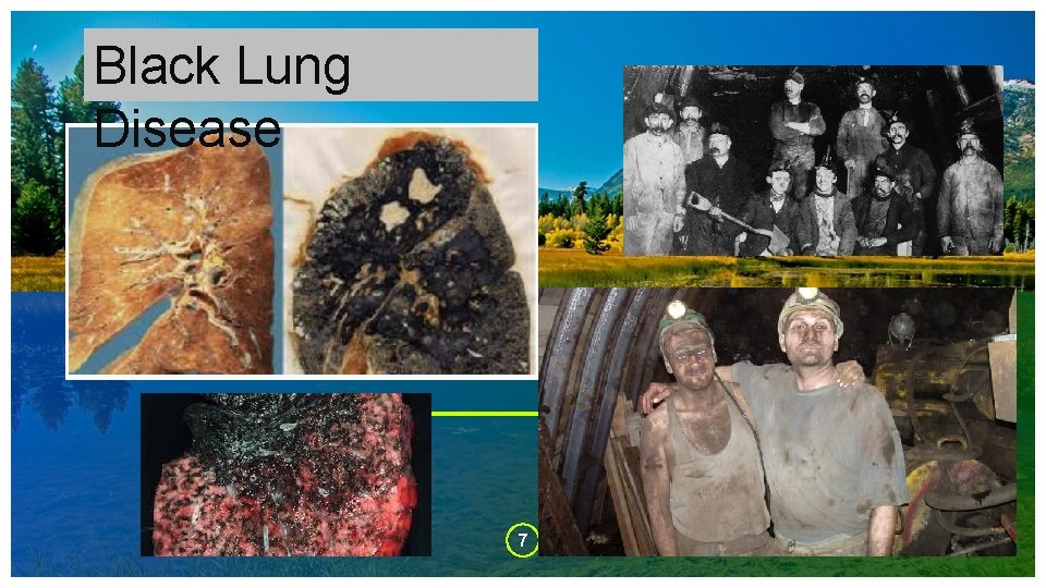 Black Lung Disease 7 