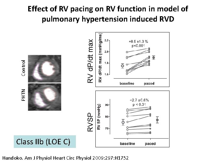 RV d. P/dt max RVSP PHTN Control Effect of RV pacing on RV function