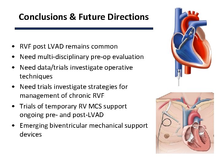 Conclusions & Future Directions • RVF post LVAD remains common • Need multi-disciplinary pre-op