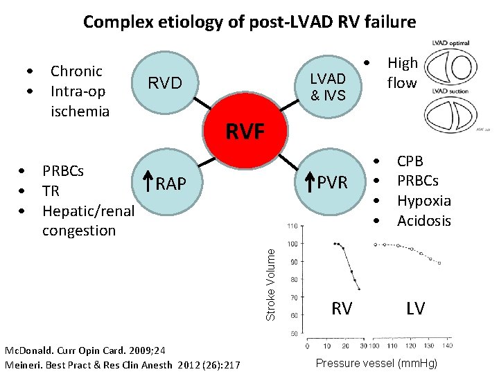 Complex etiology of post-LVAD RV failure • Chronic • Intra-op ischemia RVD & IVS