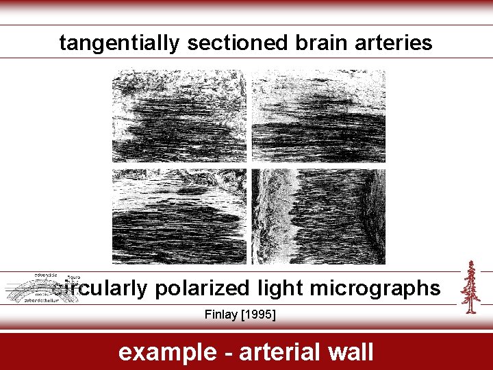 tangentially sectioned brain arteries circularly polarized light micrographs Finlay [1995] example - arterial wall