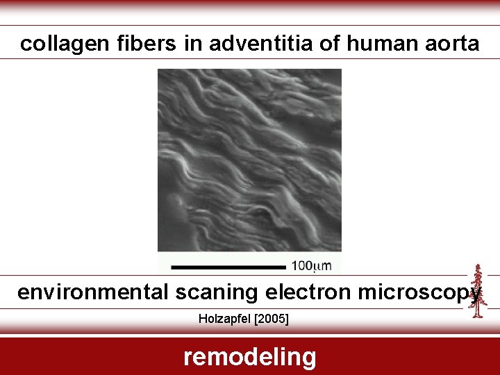 collagen fibers in adventitia of human aorta environmental scaning electron microscopy Holzapfel [2005] remodeling