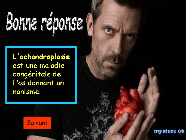 L'achondroplasie est une maladie congénitale de l ’os donnant un nanisme. Suivant 