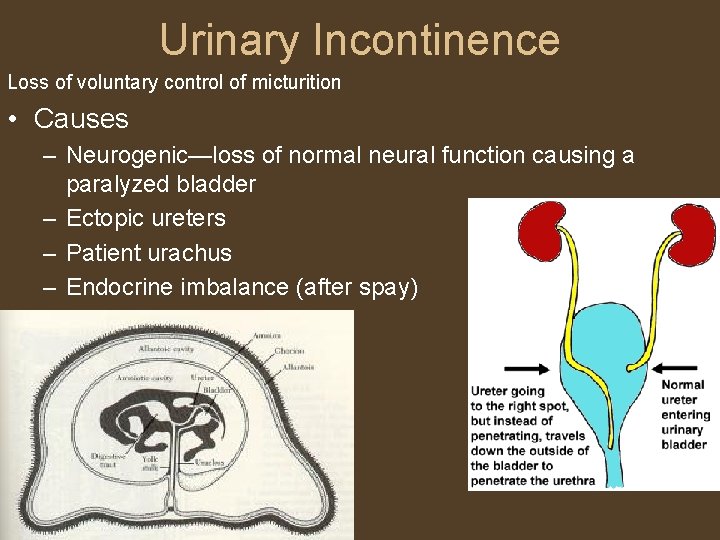 Urinary Incontinence Loss of voluntary control of micturition • Causes – Neurogenic—loss of normal