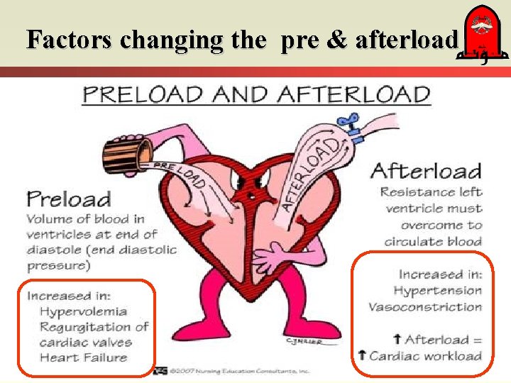 Factors changing the pre & afterload 