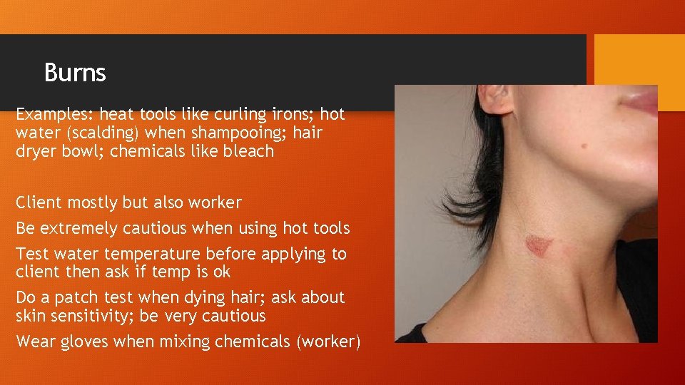 Burns Examples: heat tools like curling irons; hot water (scalding) when shampooing; hair dryer