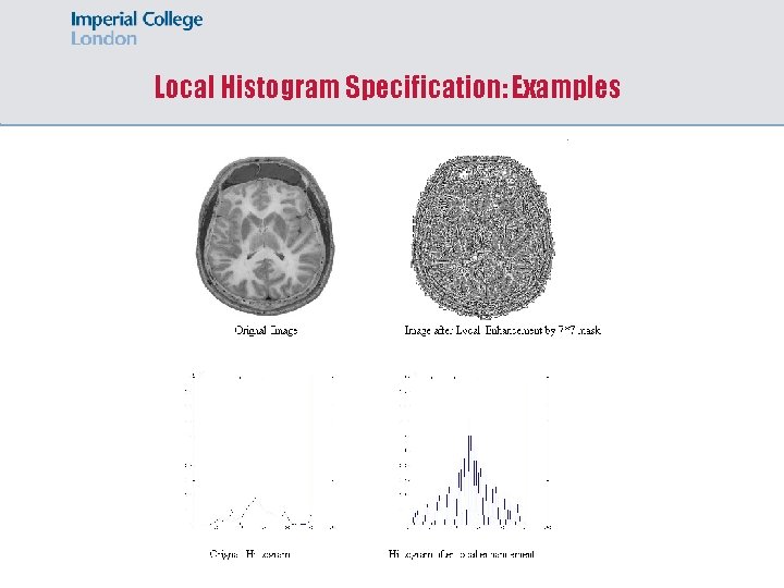 Local Histogram Specification: Examples 