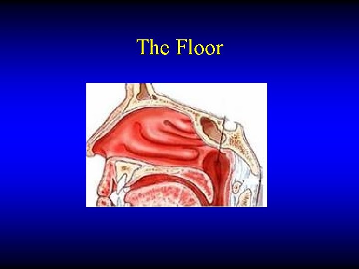 The Floor 