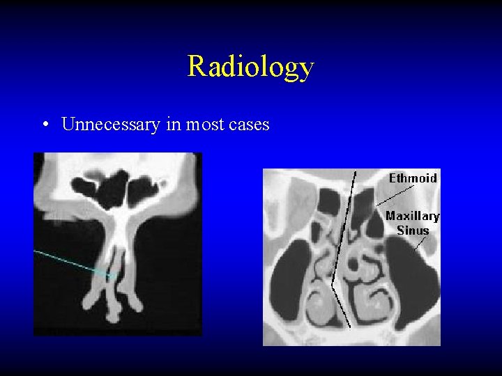 Radiology • Unnecessary in most cases 