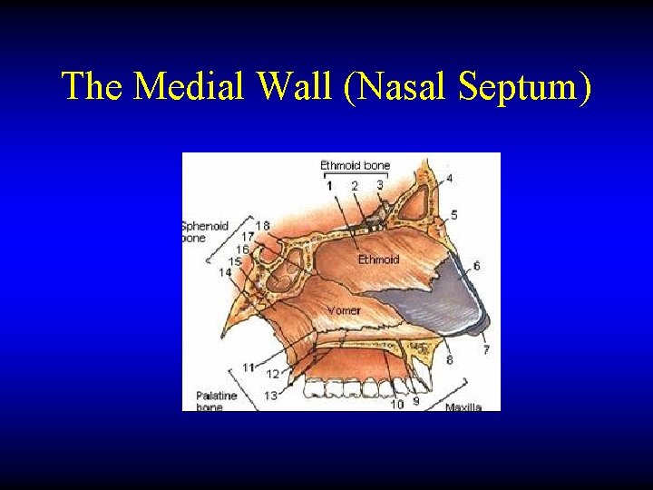 The Medial Wall (Nasal Septum) 