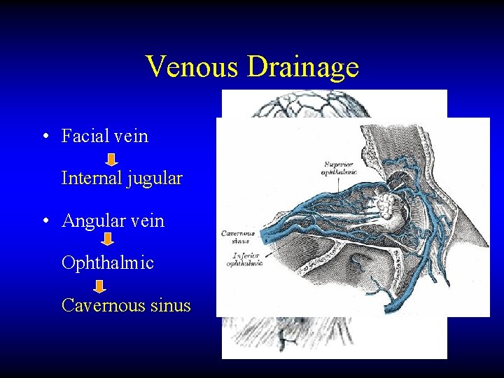 Venous Drainage • Facial vein Internal jugular • Angular vein Ophthalmic Cavernous sinus 