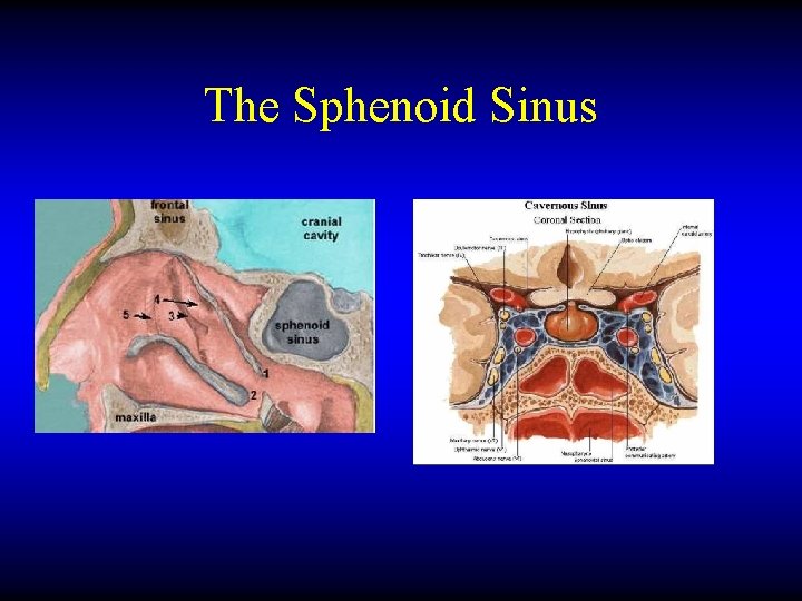 The Sphenoid Sinus 
